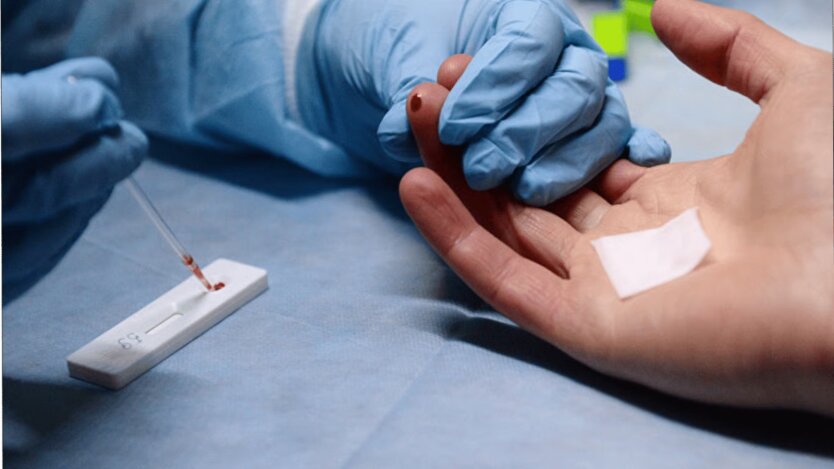 Miasto w zagrożeniu: Popienko wyjaśnił, dlaczego w Kijowie wybuchła epidemia wirusowego zapalenia wątroby typu A
